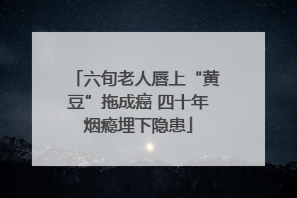 六旬老人唇上“黄豆”拖成癌 四十年烟瘾埋下隐患